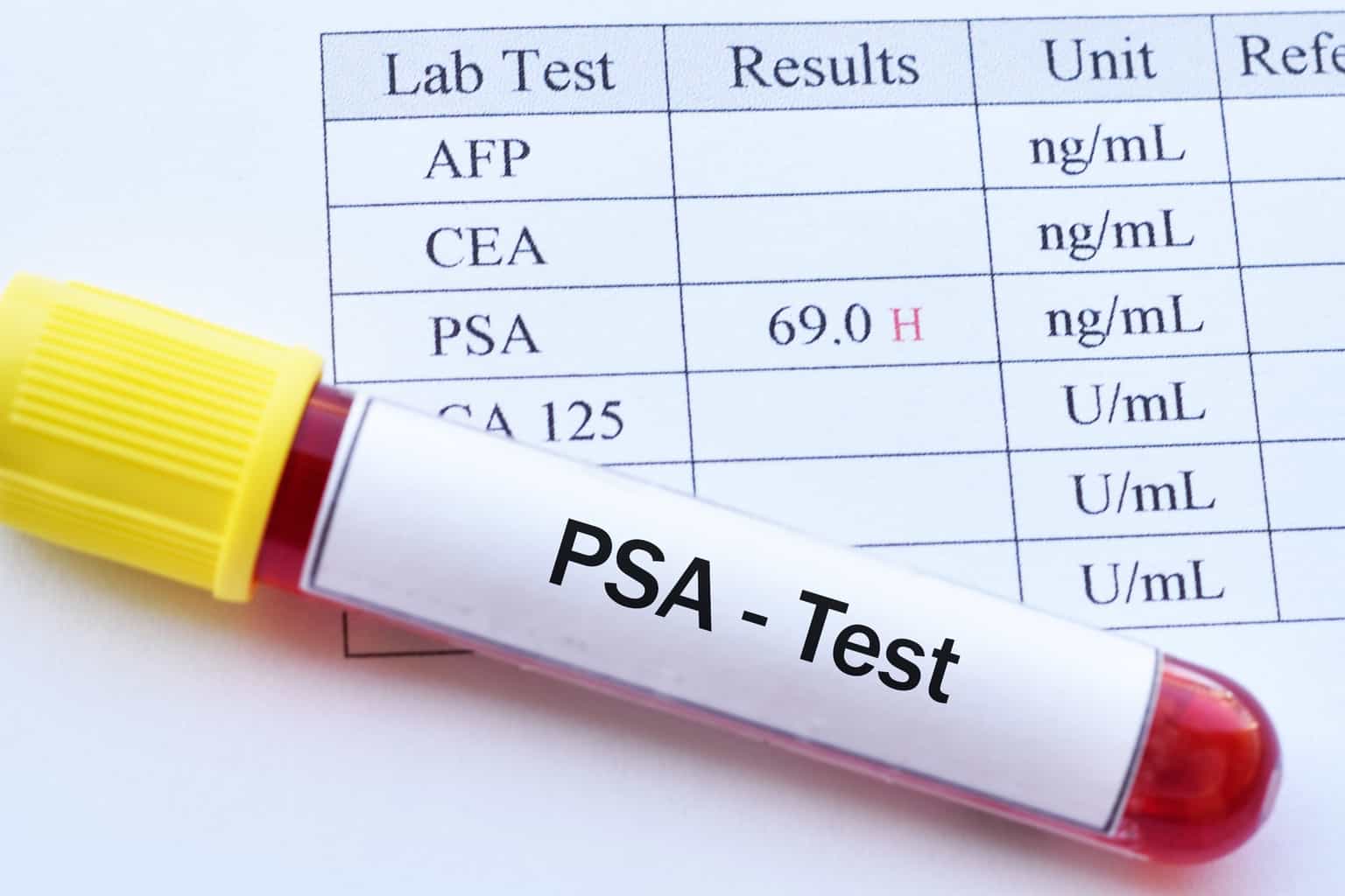 Read This Before Getting a PSA Test (Very Important) | Daily Medical ...